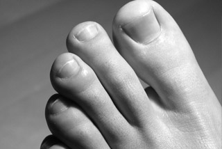 Toes and warts Care